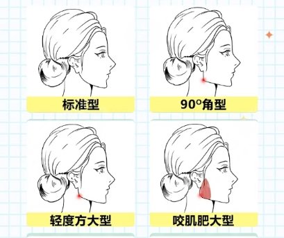 下颌角