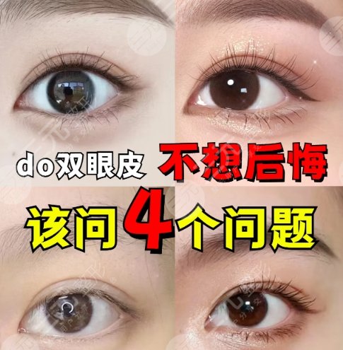 双眼皮
