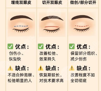 双眼皮