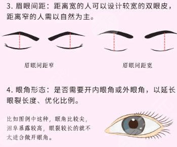 双眼皮