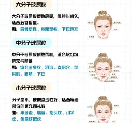 丰下巴