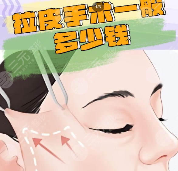 拉皮
