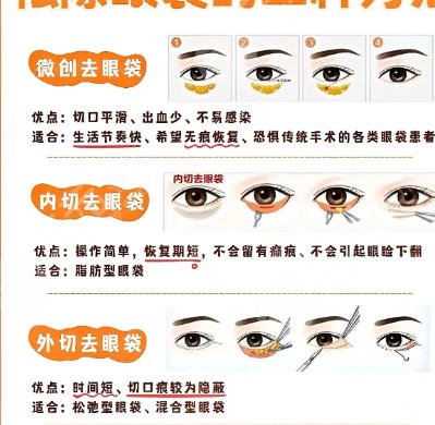 去眼袋
