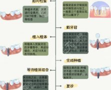 聊城人民医院种植牙价格多少钱？2026价格展示！费用低至6300元起