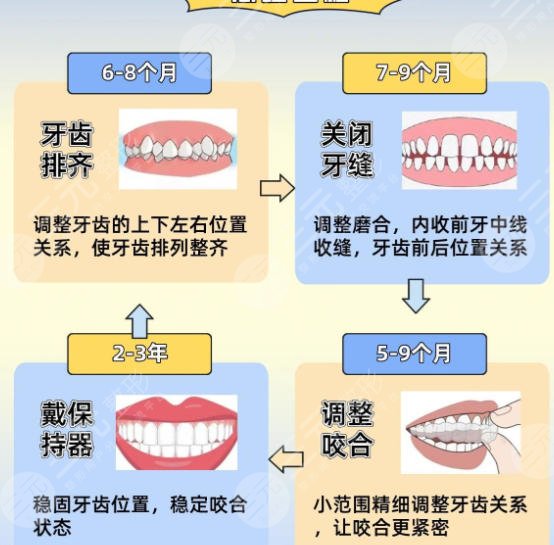 牙齿矫正