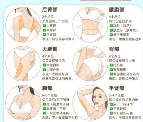 吸脂