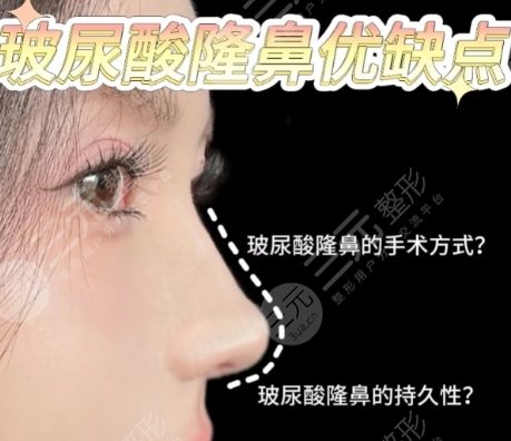 隆鼻