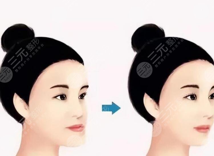 正颌