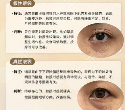 去眼袋