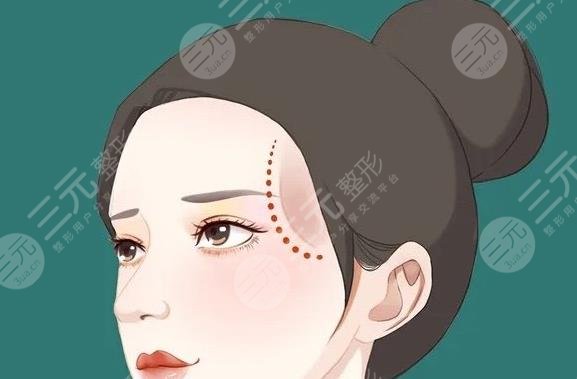 太阳穴