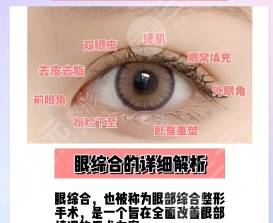 双眼皮