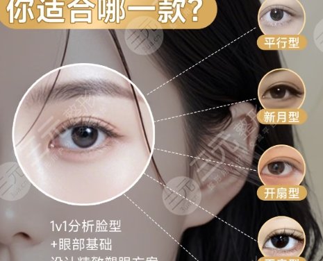 双眼皮