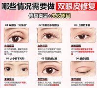 济宁第一人民医院割双眼皮多少钱？2026收费标准更新！点击收藏