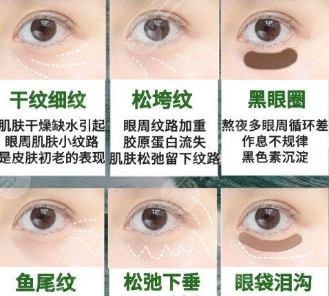 去眼袋