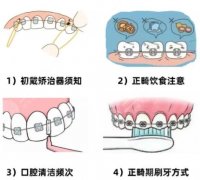 临沂人民医院牙科在哪个院区?牙齿矫正、种牙技术点评！含顾客口碑