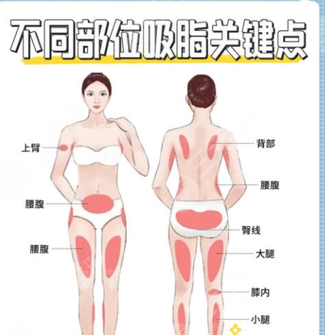 吸脂