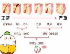 西宁第二人民医院点阵激光多少钱？价目表展示！费用低至3k左右！