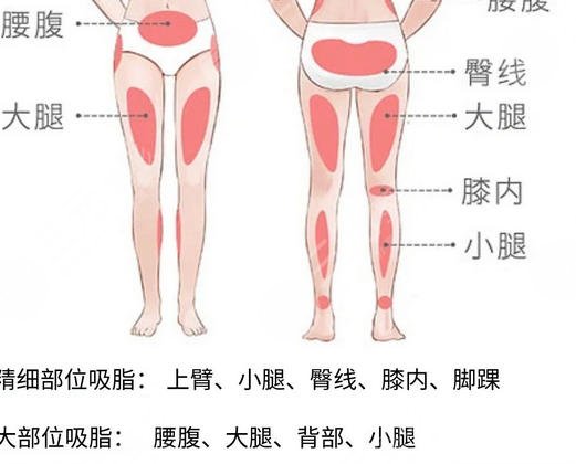 吸脂