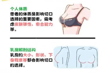 隆胸