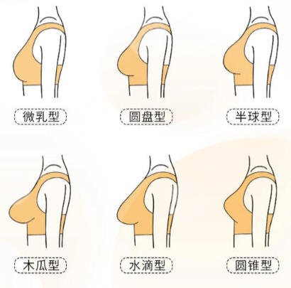 隆胸