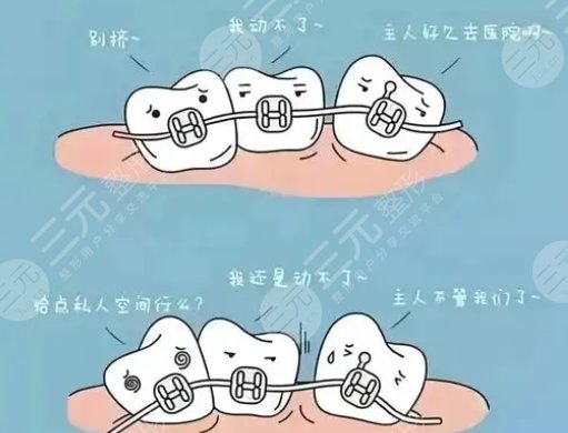 牙齿矫正