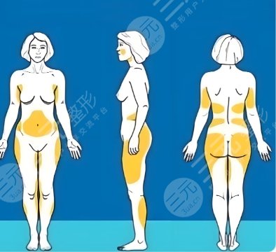 吸脂