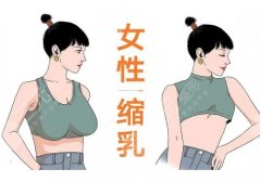 临沂人民医院整形科可以做缩胸手术吗？项目优势+人气医生团队分享