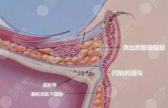 齐鲁医院去眼袋挂什么科？答：整形外科！戳进来看口碑