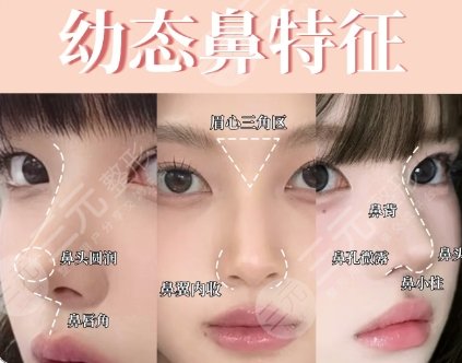 隆鼻