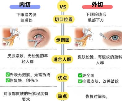 去眼袋