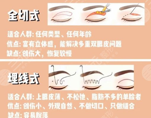 双眼皮