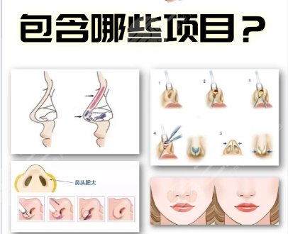 隆鼻