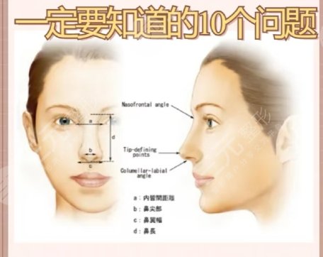 隆鼻