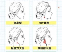 齐鲁医院做下颌角手术好吗？医院资质点评来了！戳进来了解一下