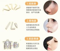 山东中医药大学第二附属医院做鼻子多少钱？26年价目表公布！预算一次性说清