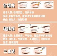滨州做双眼皮多少钱？价目表更新！双眼皮8k左右起！