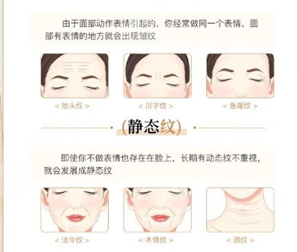 除皱