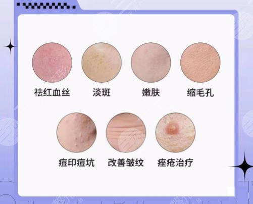 点阵激光