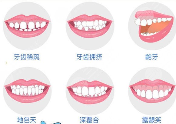 牙齿矫正