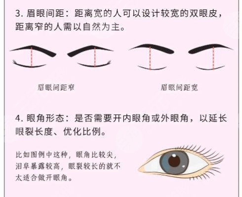 双眼皮