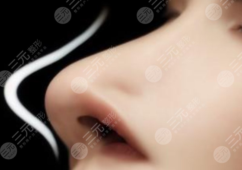 隆鼻