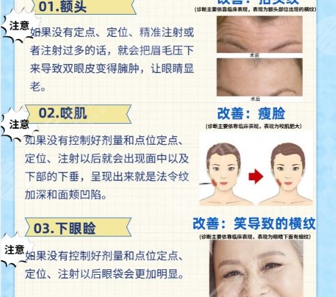 除皱