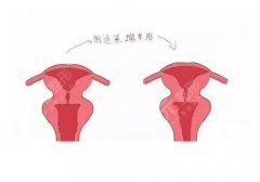 曹玉娇做手术的口碑评价怎么样？私密整形专家，口碑测评+真实案例反馈