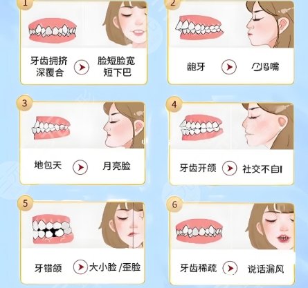 牙齿矫正