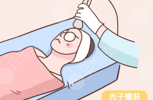 光子嫩肤