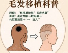青医附院植发厉害三个科室介绍！医院资质及价格公布！头顶加密2万1左右起！