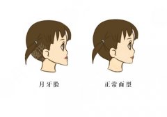 刘彦普正颌手术做得怎样？深耕颌面外科四十余载，技术精湛