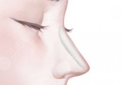 廖洪跃是整形外科医生吗？南昌大学二附院副主任，医生详情公开