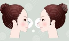 魏皎鼻子案例分享！审美与技术双在线的九院专家，详情测评来了