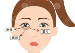 济南市中心医院祛眼袋专家怎么选？擅长方向、手术风格都整理好了